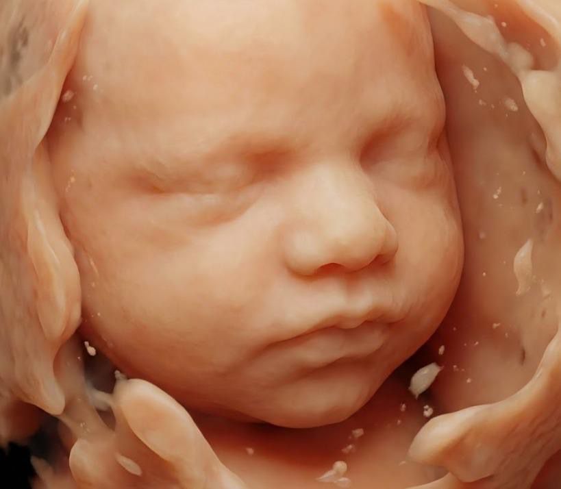 8K 4D ultrasound scan of a baby's face captured at Blooming Bellies in Doral, Miami